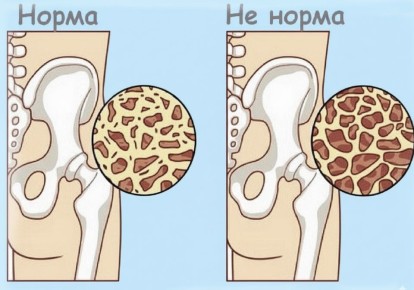 ��� ��������� ������� �����: ������� ��� �������� ����� ����� 55 ���