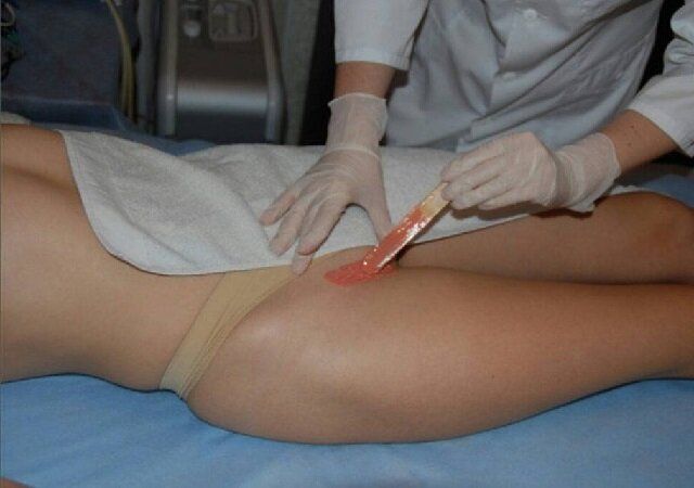 Бразильская эпиляция: секреты, методы и комфортные ощущения