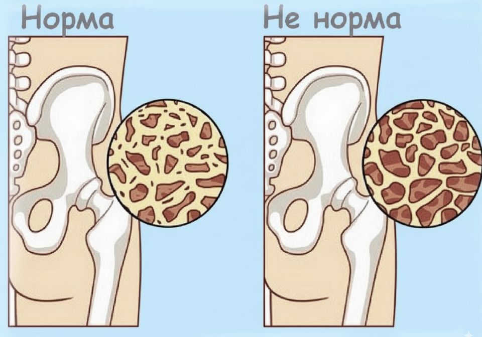 ��� ��������� ������� �����: ������� ��� �������� ����� ����� 55 ���